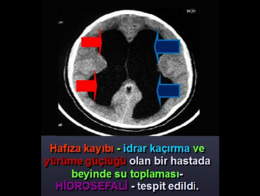 İkinci Görsel