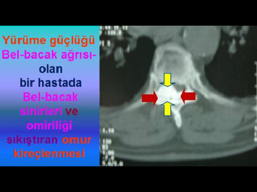 Beşinci Görsel