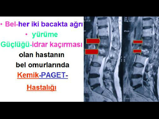 Altıncı Görsel